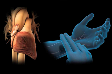 Cardiac Arrhythmia.jpg