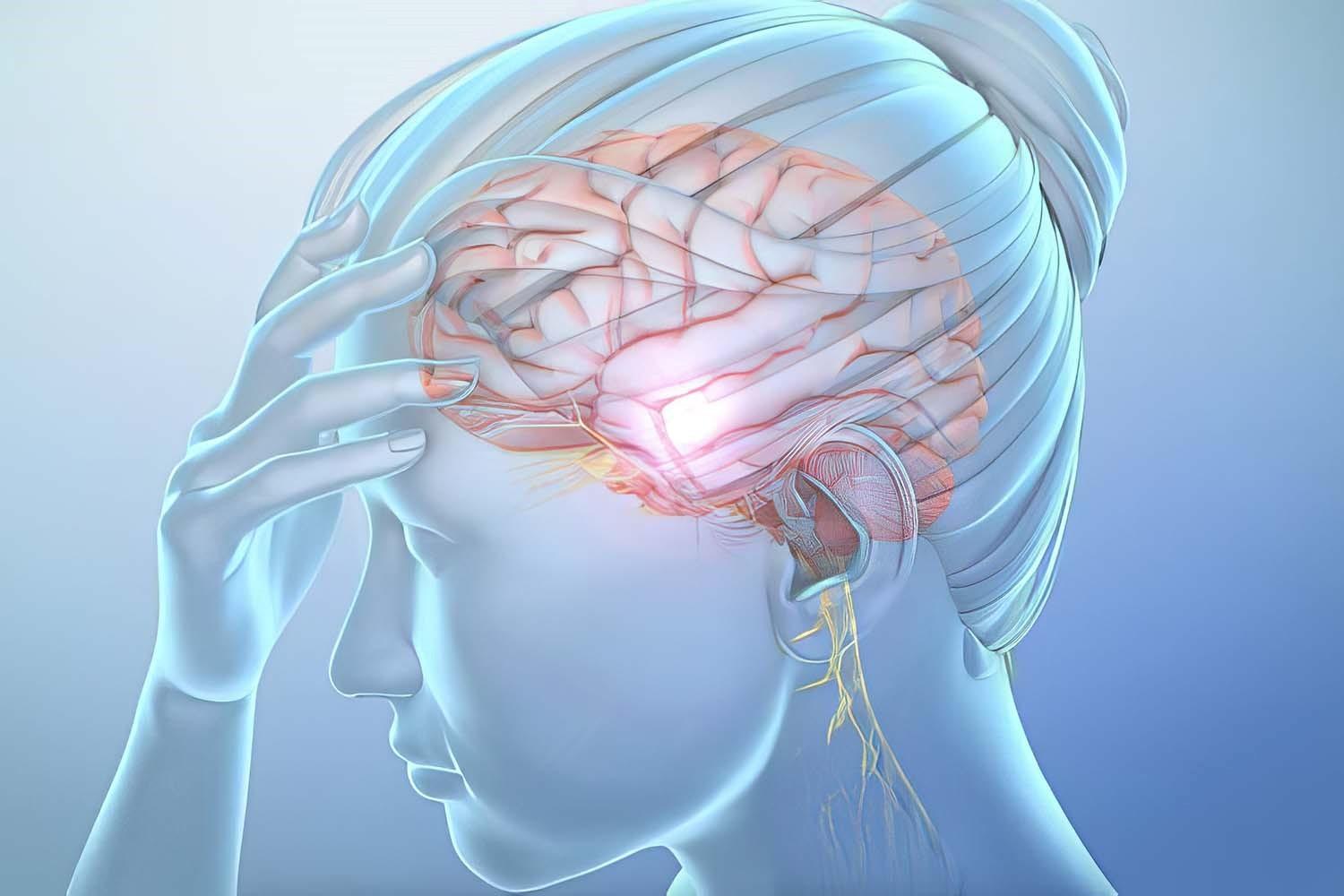 Headaches Diagnosed and Treated by Neurologists in Baltimore