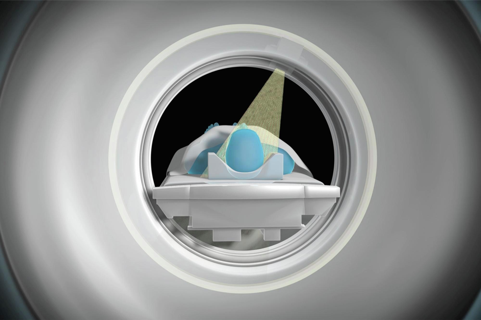 CT Scan Offered at Mercy - Baltimore - MD